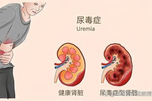 曼联蓝军近10次交手：双方曾出现5连平，最近一次曼联4-1大胜